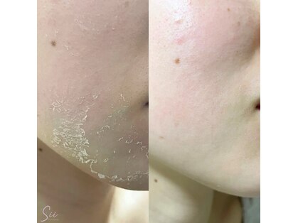 ルアナ ワックス サロン(LUANA Waxing Salon)の写真