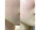ルアナ ワックス サロン(LUANA Waxing Salon)の写真