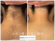 リノ(Lino)の雰囲気(丁寧なシェービングも大人気!背中脱毛&うなじ脱毛初回5,500円)