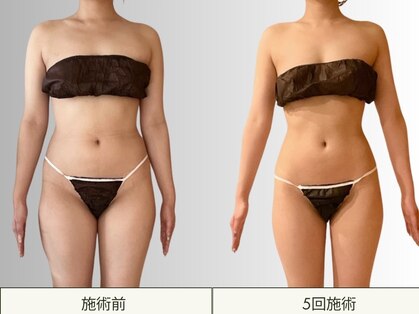 マルレ(MARLE)の写真