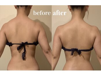 ラ セメリエ(La S'aimeriller)/経絡リンパマッサージ/菊陽町