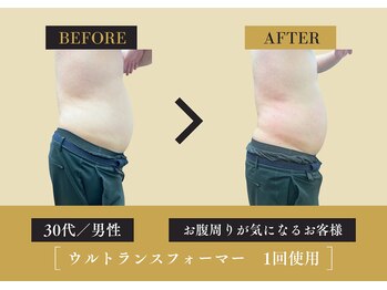 キレイ 筑紫野原田店(KIREI)/30代 お腹周りが気になる