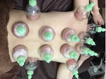 オプションでカッピングで血流改善も。