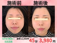 小顔美肌ファクトリー 金沢院