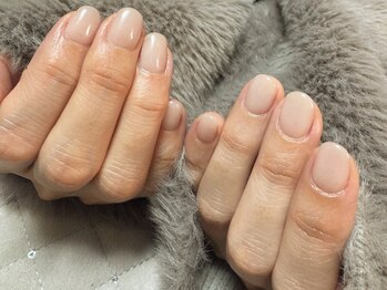 ヒロネイル アンド ビューティーサロン(hironail)の写真/自爪育成の技術に定評あり！ケラチン配合ジェルでちび爪・巻き爪も美爪へ☆深爪/自爪育成/自爪/ケア
