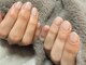 ヒロネイル アンド ビューティーサロン(hironail)の写真/自爪育成の技術に定評あり！ケラチン配合ジェルでちび爪・巻き爪も美爪へ☆深爪/自爪育成/自爪/ケア