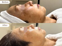 エスラ 中目黒店(S:RA)の雰囲気（【医療提携フェイシャル】医師開発のマシン・美容液で本格肌管理）
