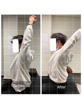 ナオル整体 浅草院(NAORU整体)/10代男性中腰で腰痛【バンザイ】