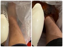 ビップルーム バイ パルティール(VIP ROOM by Partir)/デトックス足湯