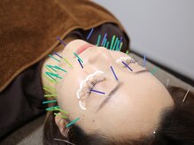 久留米鍼灸整体サロン