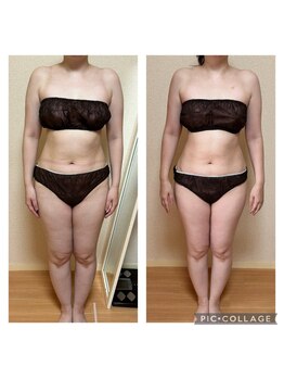 ヨサパーク スマイル(YOSA PARK SMILE)/効果事例