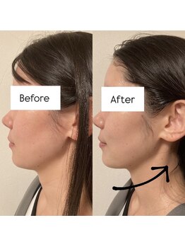 ひっそり美肌構築/フェイスライン♪