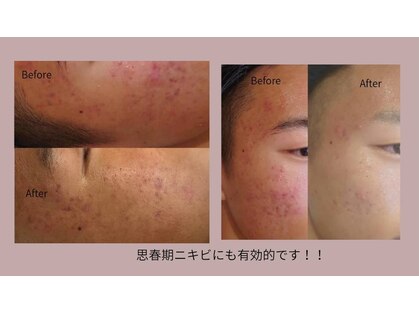 ベル(Belle)の写真