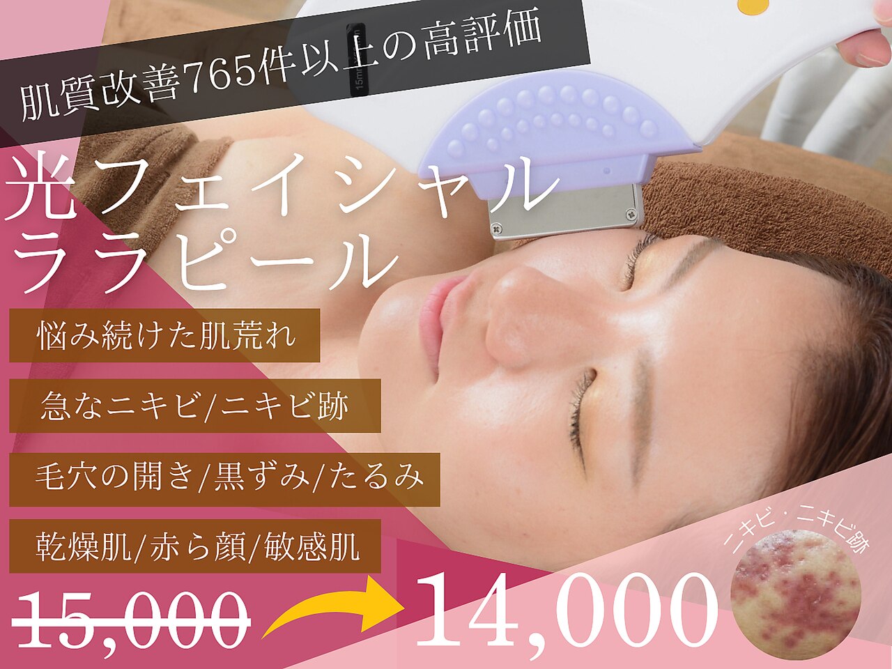 大阪市城東区でフェイシャルエステが人気のエステサロン