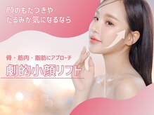 エスポワール(espoir)