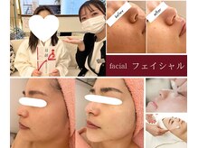 ピュアノア 三木店の雰囲気（”肌質改善”水光肌ピーリングフェイシャル剥離しない美白美肌）