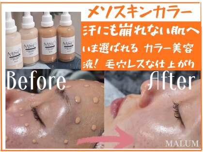 マールム(MALUM)の写真
