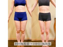 アンジー(Angie)/美脚に大変身