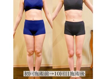 アンジー(Angie)/美脚に大変身