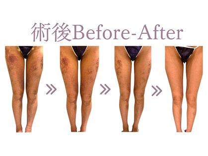 マドモアゼル 麻布十番の写真