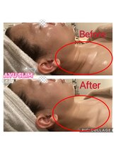 アユスリム(AYU SLIM)/一回でも変化できるの充実美顔