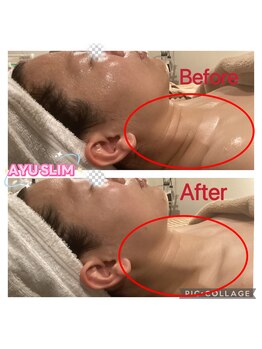 アユスリム(AYU SLIM)/一回でも変化できるの充実美顔