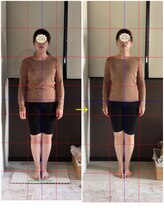 リラクゼーションアンドビューティー コウ(Kou)/【美容整骨/ブライダル矯正】