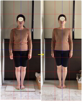 リラクゼーションアンドビューティー コウ(Kou)/【美容整骨/ブライダル矯正】