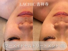 ラシク 吉祥寺(LACHIC)/リアボーテフェイシャルコース