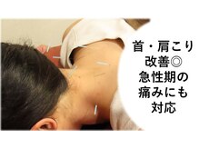 高橋整骨院鍼灸院の雰囲気（延べ１２万人施術実績！身体の不調はお任せください！）