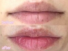 カシェット(cachette)/ローマピンク・リップ