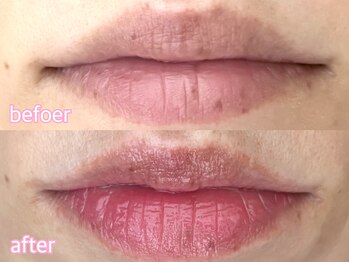 カシェット(cachette)/ローマピンク・リップ