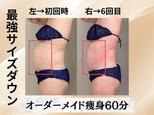 イヨヨ(iyoyo)/【痩身】Before After