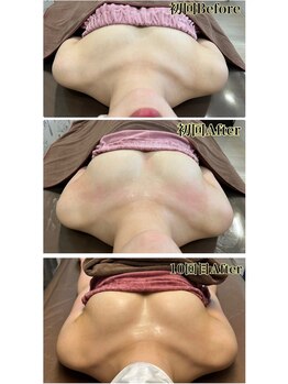 ロココ 錦糸町店(Rococo)/比較写真