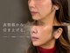 レミュー(remiu)の写真