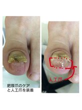 ドクターネイル爪革命 江戸川橋店/爪の大きさは重要です