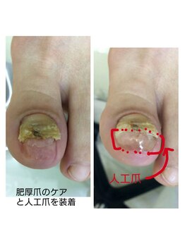 ドクターネイル爪革命 江戸川橋店/爪の大きさは重要です