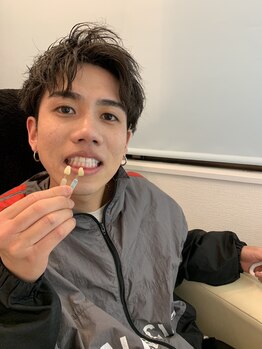 ラブホワイトニング 新宿店(LOVEホワイトニング)/ホワイトニングビフォーアフター
