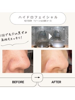 マヴィ 香里園店(MavY.)/新感覚水素で洗う次世代毛穴洗浄