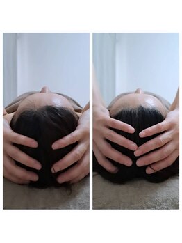 ネマウム(nemaum)/脳美容(ドライヘッドスパ)