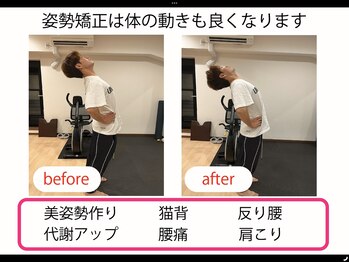 中京こじま整骨院/姿勢矯正