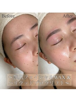エレーナ(ELENA)/艶肌フェイシャルWAX＋HBL