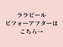 ア クーユ 稲毛店/ララピールビフォーアフター♪