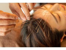 はりひろし鍼灸院/脳疲労は慢性化します