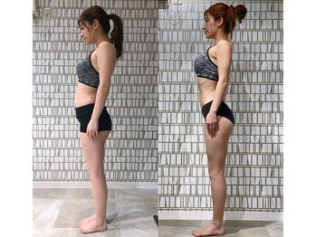 イーストレッチジム 大阪心斎橋店(E-STRETCH GYM)/ビフォーアフター
