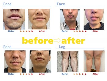 キングスサロン 熊本