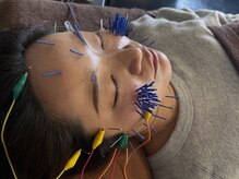 まつもと美容鍼灸整体サロン