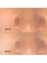 エムアンドユウ(m&u)/息子に言われた一言