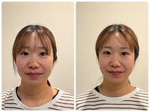 たかさきひかり鍼灸整骨院/お客さんBeforeAfter