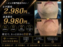 シャイン 佐賀店(SHINE)